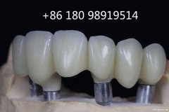 深圳义齿加工厂 诚邀海外华人各位牙科医生，牙科技师，牙诊所和